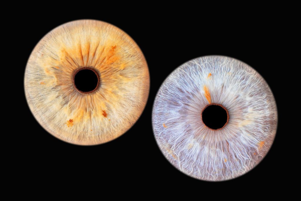Iris-photographie-couple-explosion-lens-bethune-la-bassee-lille-auchy-les-mines-melody-bucci-photographe-59-62-auts-de-france